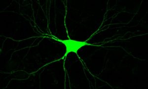 green-neuron-resized-image-500x300